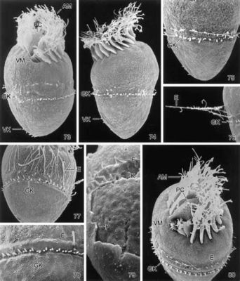  Strombidium: Une merveille microscopique qui bouge comme une danseuse endiablée!